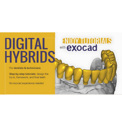 Digital Hybrids for Dentists & Technicians